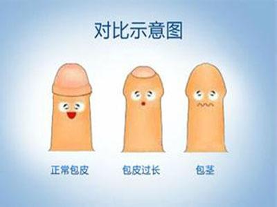 ͰƤô